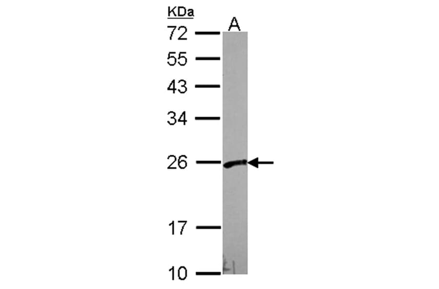 VBP1 antibody from Signalway Antibody (22061) - Antibodies.com