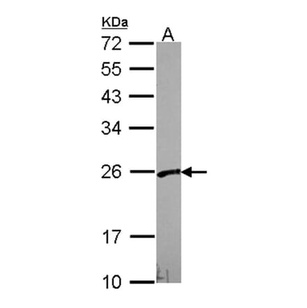 VBP1 antibody from Signalway Antibody (22061) - Antibodies.com