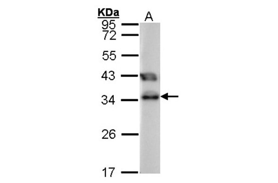 TTC1 antibody from Signalway Antibody (22068) - Antibodies.com