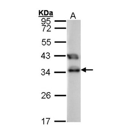 TTC1 antibody from Signalway Antibody (22068) - Antibodies.com
