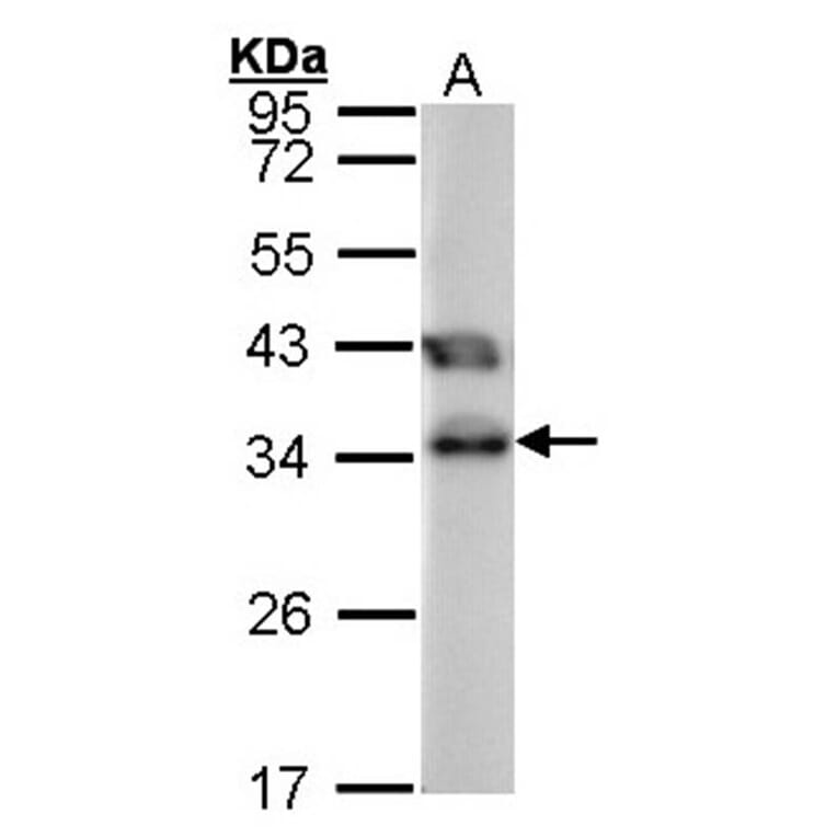 TTC1 antibody from Signalway Antibody (22068) - Antibodies.com