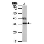 TTC1 antibody from Signalway Antibody (22068) - Antibodies.com