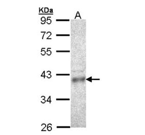 CPOX antibody from Signalway Antibody (22127) - Antibodies.com