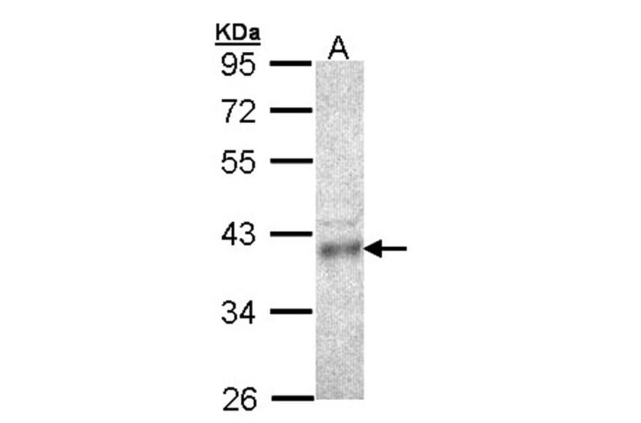 CPOX antibody from Signalway Antibody (22127) - Antibodies.com