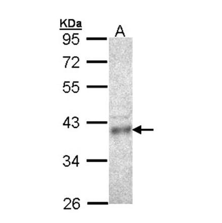CPOX antibody from Signalway Antibody (22127) - Antibodies.com