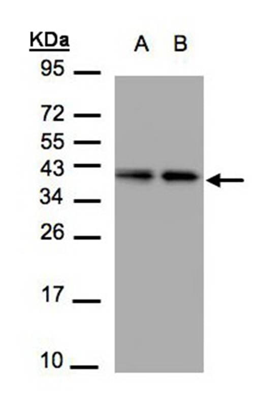 Sample (30 µg of whole cell lysate) A431B: H129912% SDS PAGE Primary antibody diluted at 1: 1500