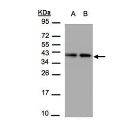 TBCC antibody from Signalway Antibody (22130) - Antibodies.com