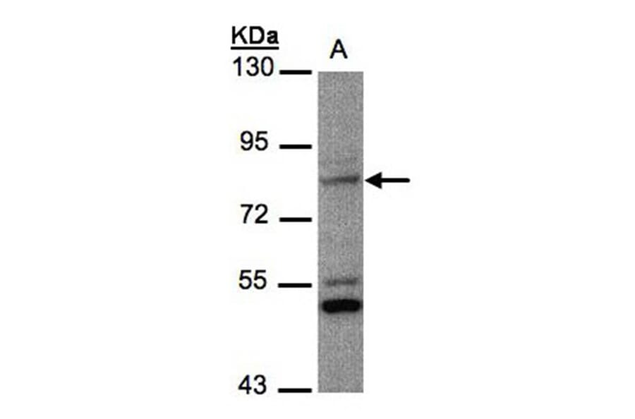 PHEX antibody from Signalway Antibody (22133) - Antibodies.com