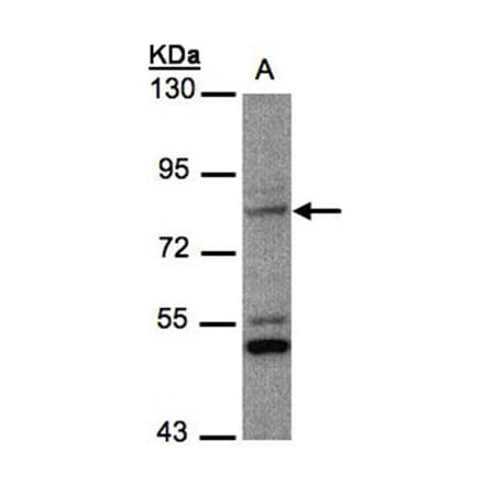 PHEX antibody from Signalway Antibody (22133) - Antibodies.com