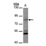 PHEX antibody from Signalway Antibody (22133) - Antibodies.com