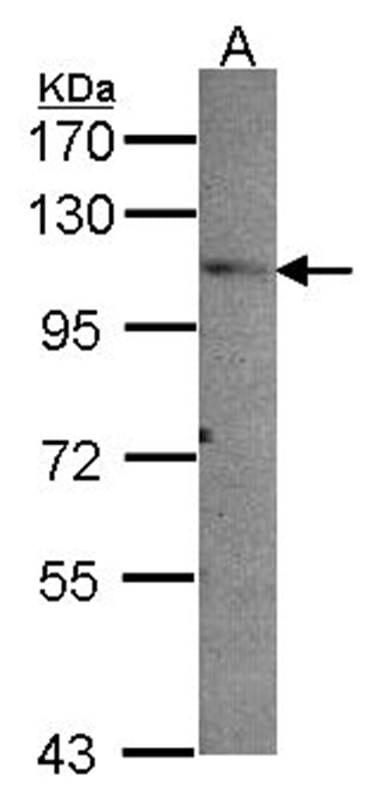 Sample (30 µg of whole cell lysate)  A549 7.5% SDS PAGE Primary antibody diluted at 1: 1000