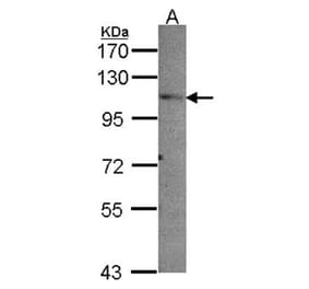 PEX6 antibody from Signalway Antibody (22206) - Antibodies.com