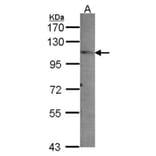 PEX6 antibody from Signalway Antibody (22206) - Antibodies.com