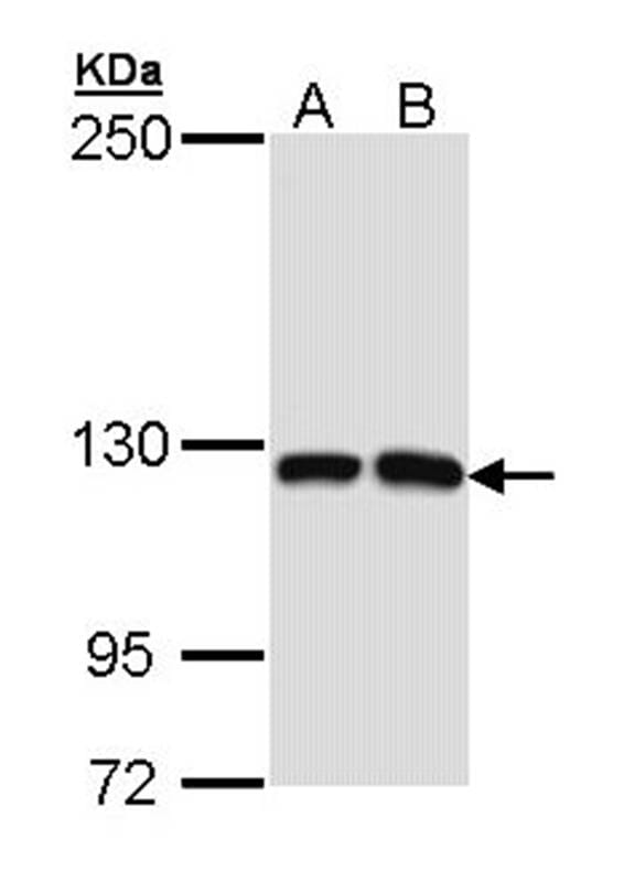 Sample (30 µg of whole cell lysate)  Molt-4 B: Raji 5% SDS PAGE Primary antibody diluted at 1: 1000