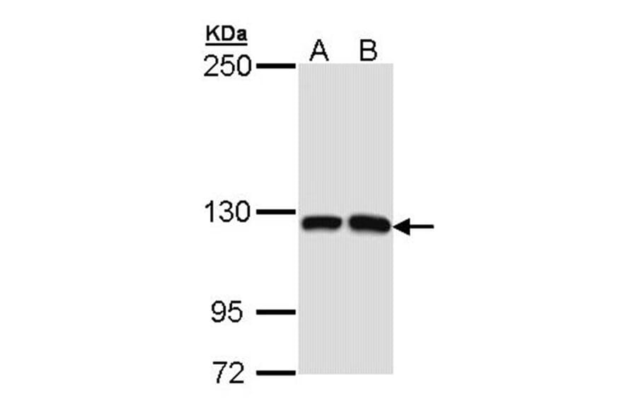 Dbs antibody from Signalway Antibody (22234) - Antibodies.com