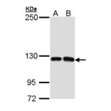 Dbs antibody from Signalway Antibody (22234) - Antibodies.com