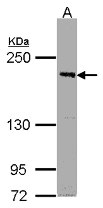 Sample (30ug whole cell lysate) Raji 5% SDS PAGE Primary antibody diluted at 1: 1000
