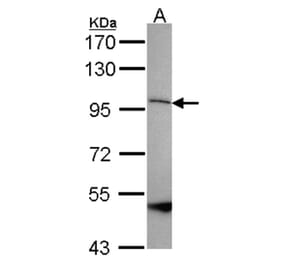 SPG7 antibody from Signalway Antibody (22251) - Antibodies.com