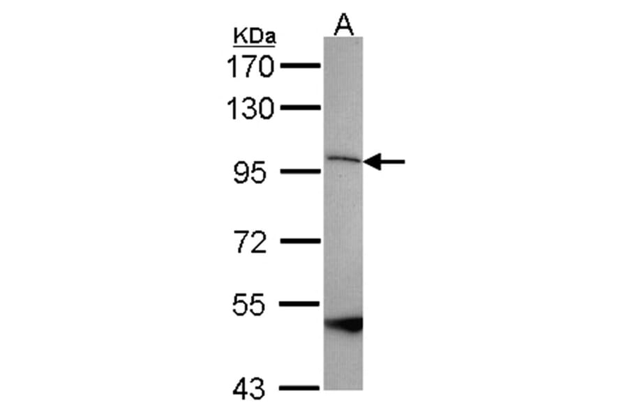 SPG7 antibody from Signalway Antibody (22251) - Antibodies.com
