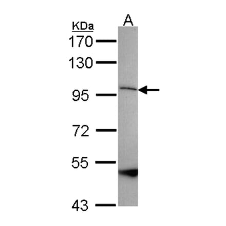 SPG7 antibody from Signalway Antibody (22251) - Antibodies.com
