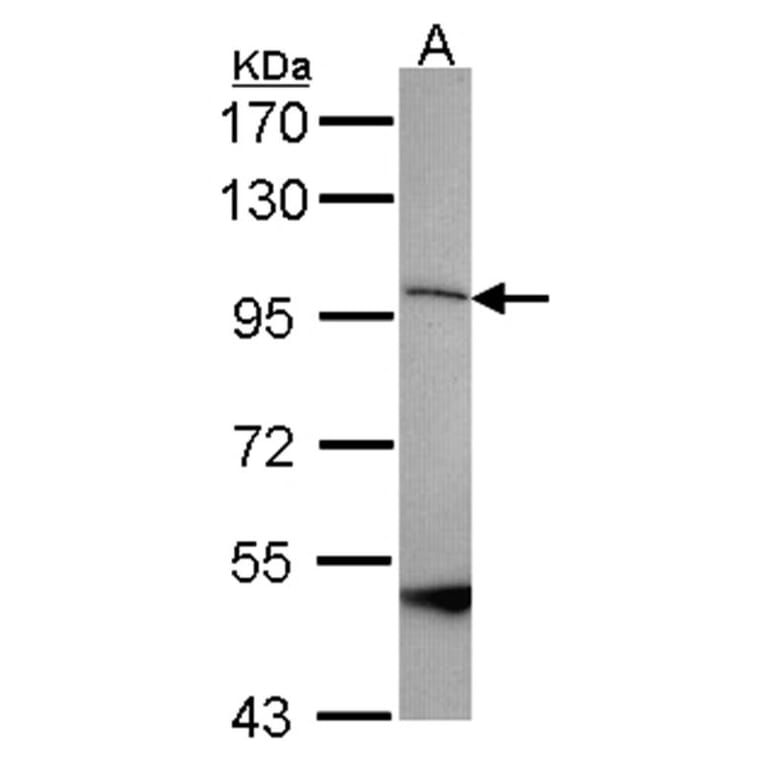 SPG7 antibody from Signalway Antibody (22251) - Antibodies.com