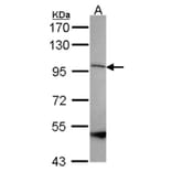 SPG7 antibody from Signalway Antibody (22251) - Antibodies.com