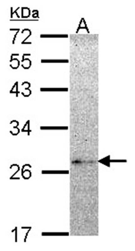 Sample (30 µg of whole cell lysate)  Hela 12% SDS PAGE NME5 antibody diluted at 1: 1000