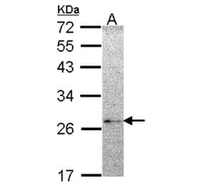 NME5 antibody from Signalway Antibody (22253) - Antibodies.com