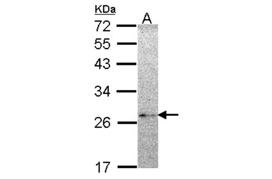 NME5 antibody from Signalway Antibody (22253) - Antibodies.com