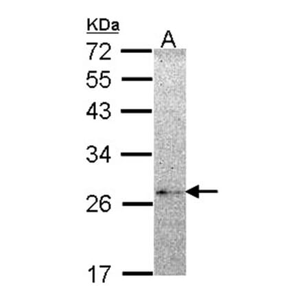 NME5 antibody from Signalway Antibody (22253) - Antibodies.com