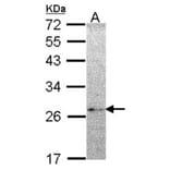 NME5 antibody from Signalway Antibody (22253) - Antibodies.com