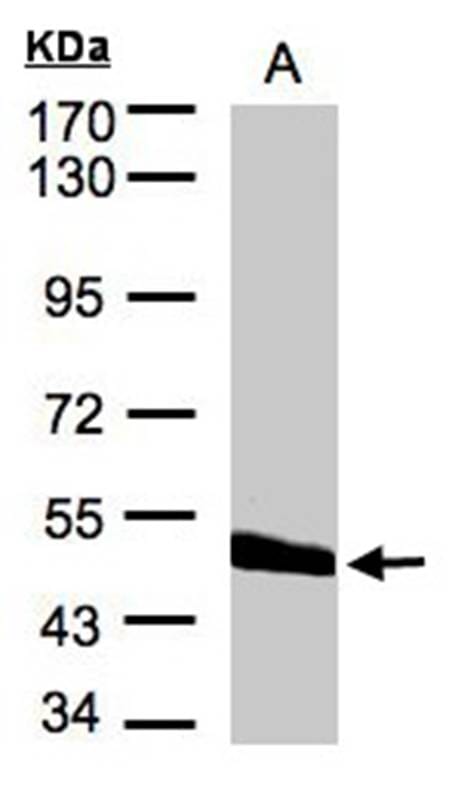 Sample (30 µg of whole cell lysate) Hep G27.5% SDS PAGE Primary antibody diluted at 1: 2000