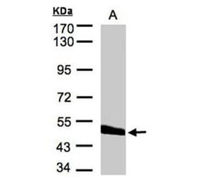CPVL antibody from Signalway Antibody (22265) - Antibodies.com