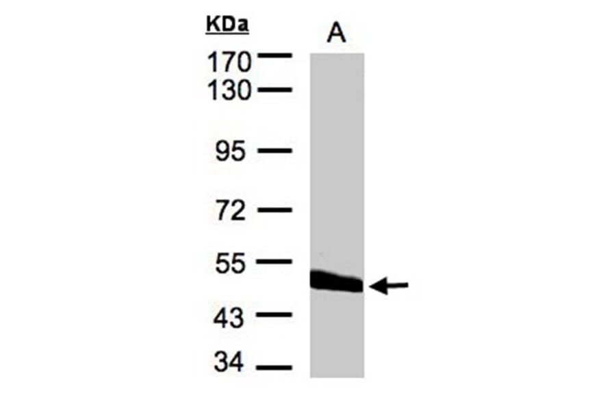 CPVL antibody from Signalway Antibody (22265) - Antibodies.com