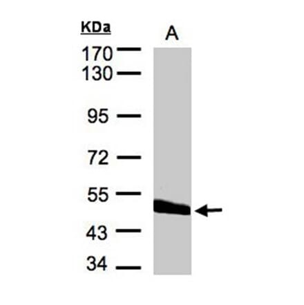 CPVL antibody from Signalway Antibody (22265) - Antibodies.com