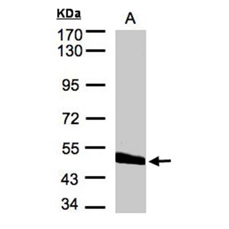 CPVL antibody from Signalway Antibody (22265) - Antibodies.com