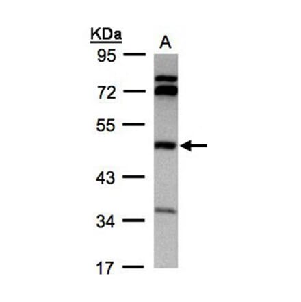 BHMT antibody from Signalway Antibody (22304) - Antibodies.com