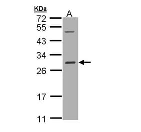 RALB antibody from Signalway Antibody (22306) - Antibodies.com
