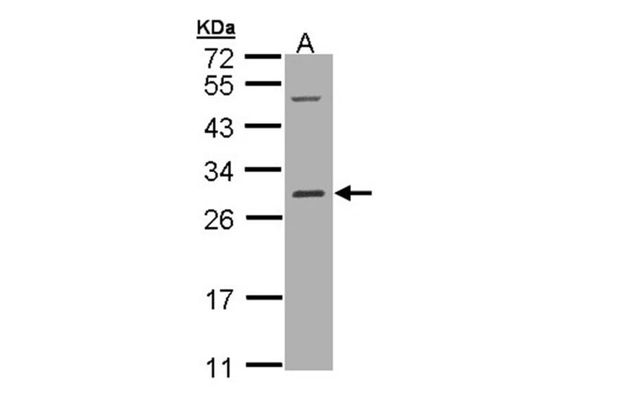 RALB antibody from Signalway Antibody (22306) - Antibodies.com