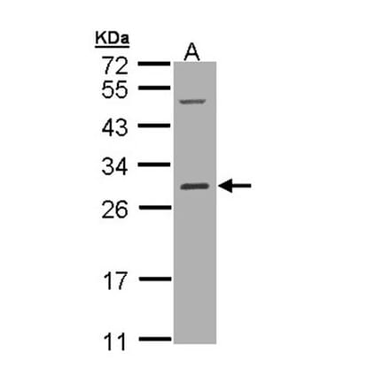 RALB antibody from Signalway Antibody (22306) - Antibodies.com