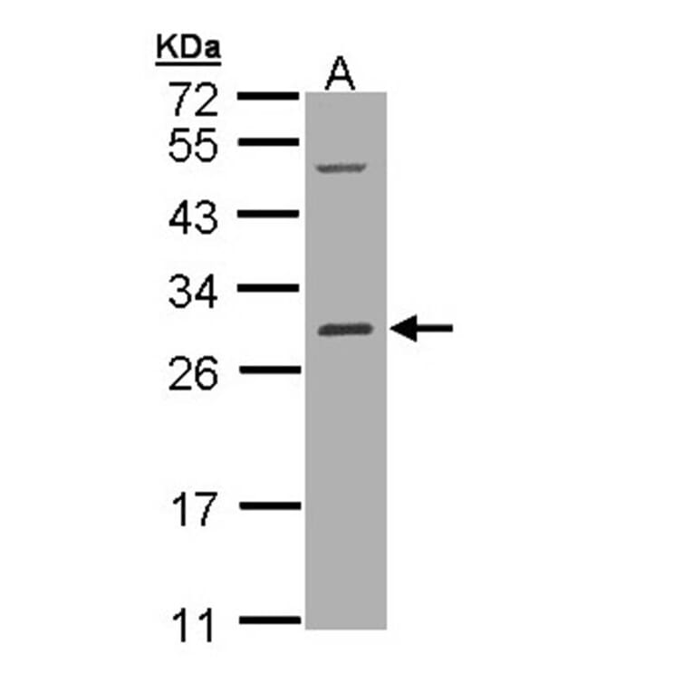 RALB antibody from Signalway Antibody (22306) - Antibodies.com