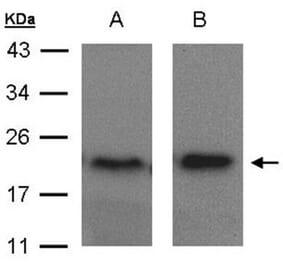 ARF5 antibody from Signalway Antibody (22315) - Antibodies.com