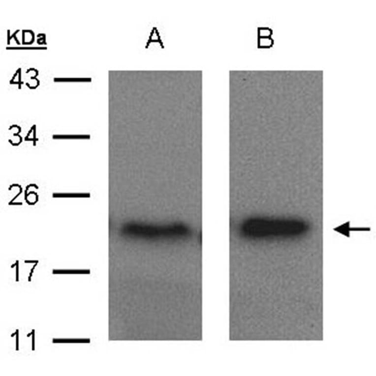 ARF5 antibody from Signalway Antibody (22315) - Antibodies.com