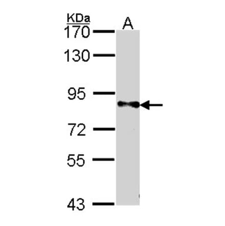 DPYD antibody from Signalway Antibody (22317) - Antibodies.com