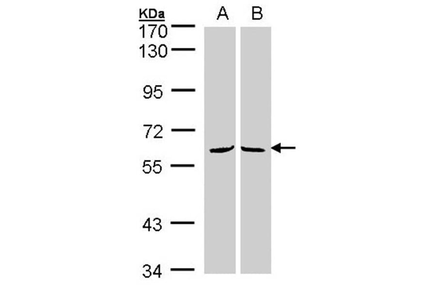 MPP3 antibody from Signalway Antibody (22348) - Antibodies.com