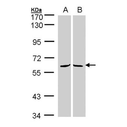 MPP3 antibody from Signalway Antibody (22348) - Antibodies.com