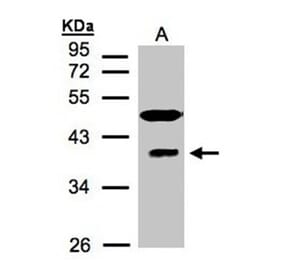RAE1 antibody from Signalway Antibody (22381) - Antibodies.com