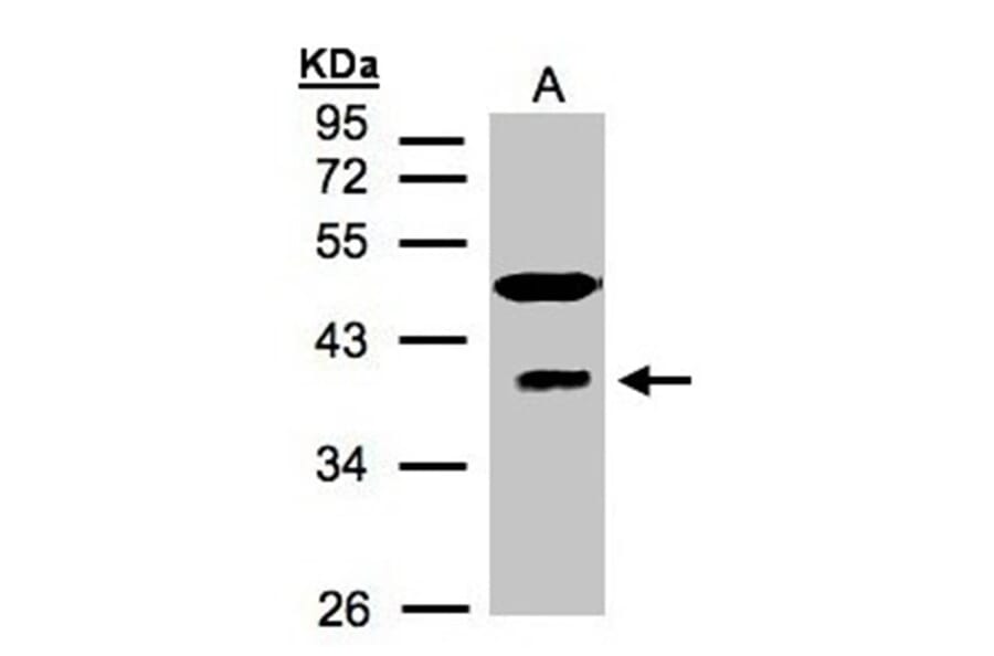 RAE1 antibody from Signalway Antibody (22381) - Antibodies.com