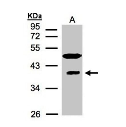 RAE1 antibody from Signalway Antibody (22381) - Antibodies.com