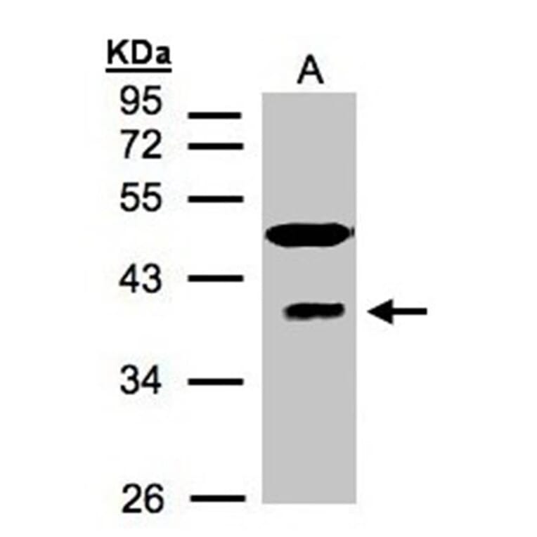 RAE1 antibody from Signalway Antibody (22381) - Antibodies.com